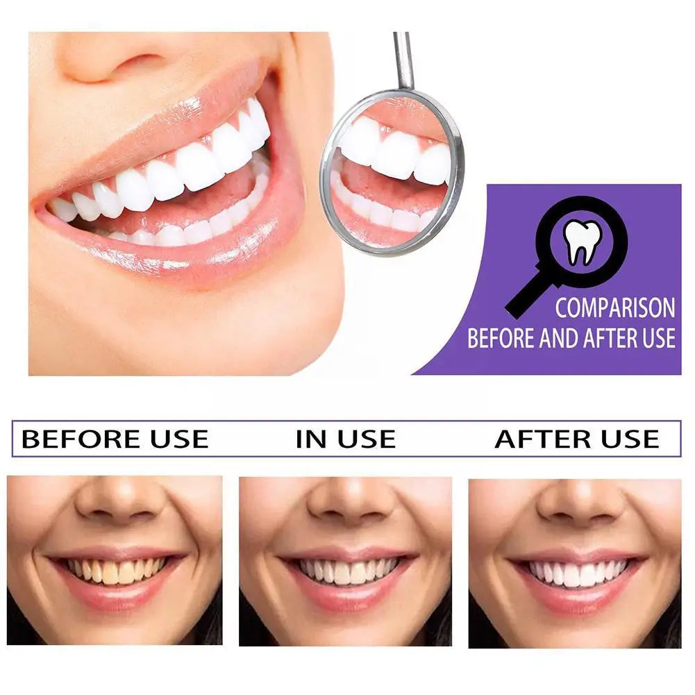 100g ISME Rasyan Herbal Clove Toothpaste Teeth Whitening Dental Paste Care Dentifrice Remove Dental Tooth Oral Stains Pasta V9O7 - Dr. Gabriel